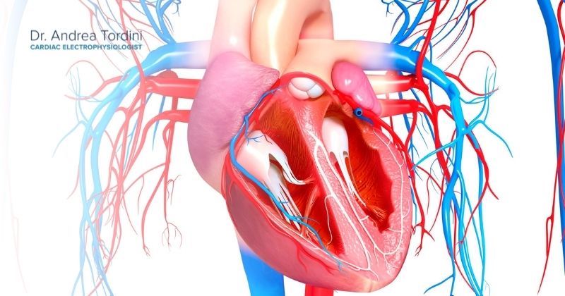 Medical illustration of the human heart shows inside of ventricles and where a cardiac catheter ablation takes place.