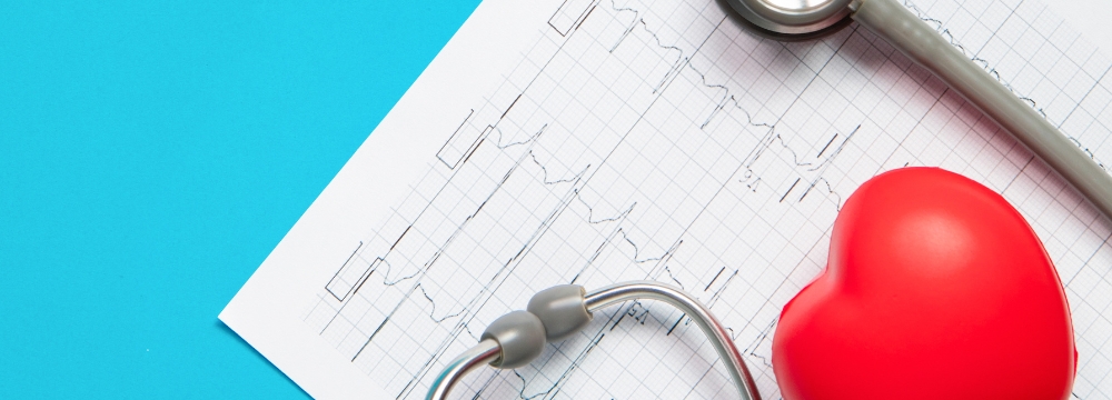 stethoscope and fake heart lying on top of a paper EKG reading