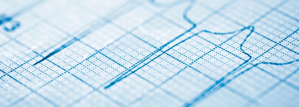 Close up of blue EKG lines